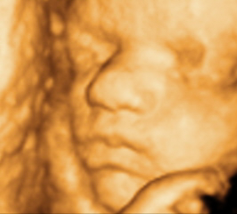 privat gynekolog 3D ultralyd timebestilling konsultasjon henvisning spesialist fødselshjelp kvinnesykdom kvinnehelse