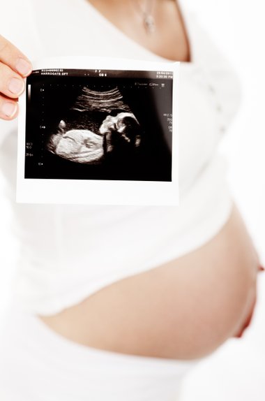gravid ultralyd tidlig 3D/4D fosterdiagnostikk svangerskap